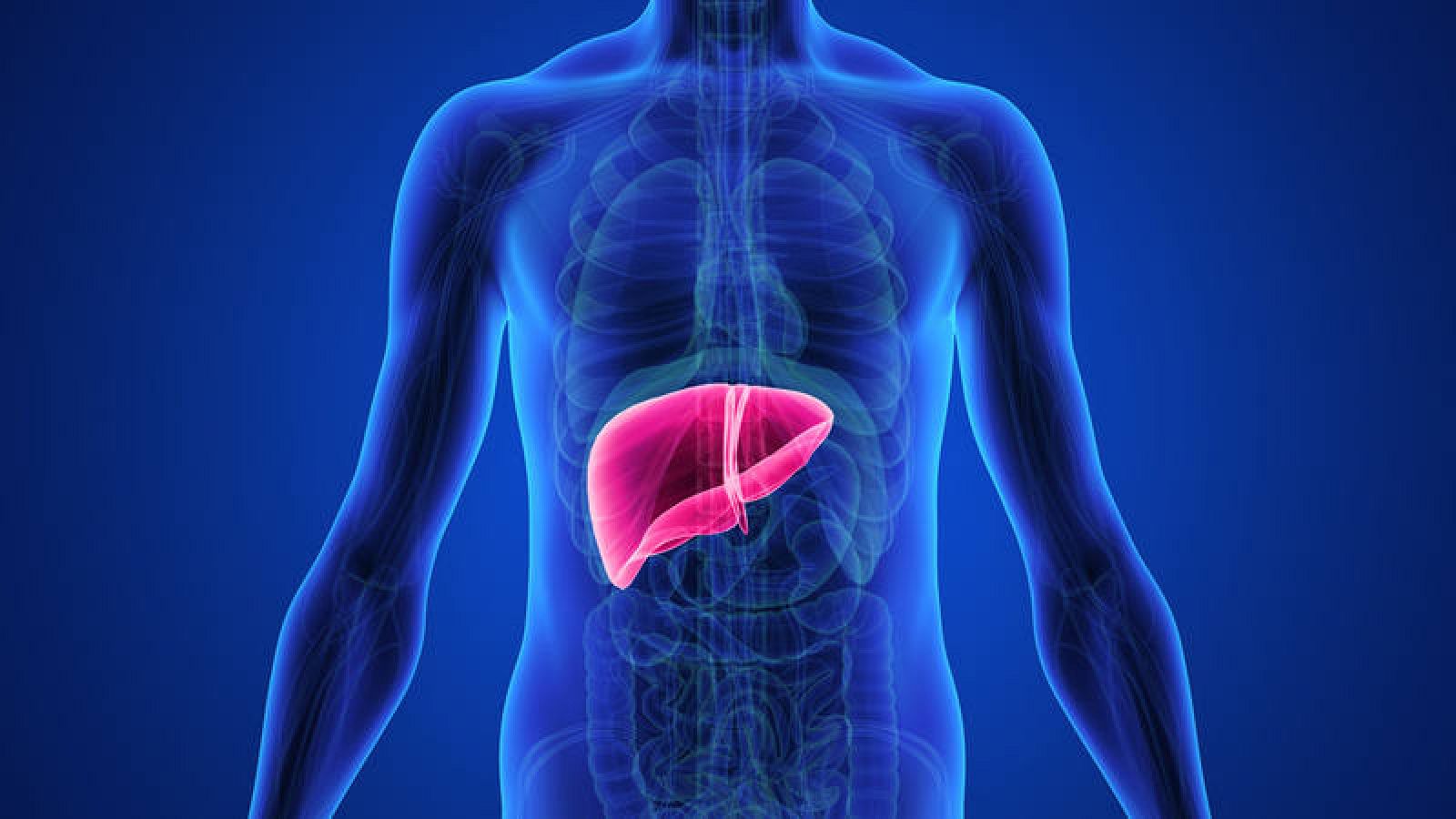 El carcinoma hepatocelular representa entre el 70-85 % de los tumores hepáticos malignos.