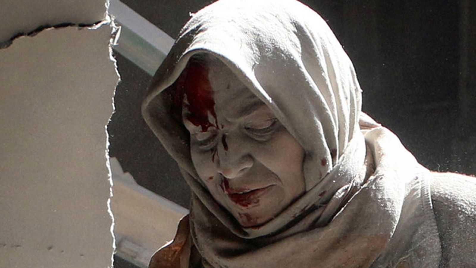 Una mujer herida tras un bombardeo aéreo en la zona oriental de Alepo en abril de 2016