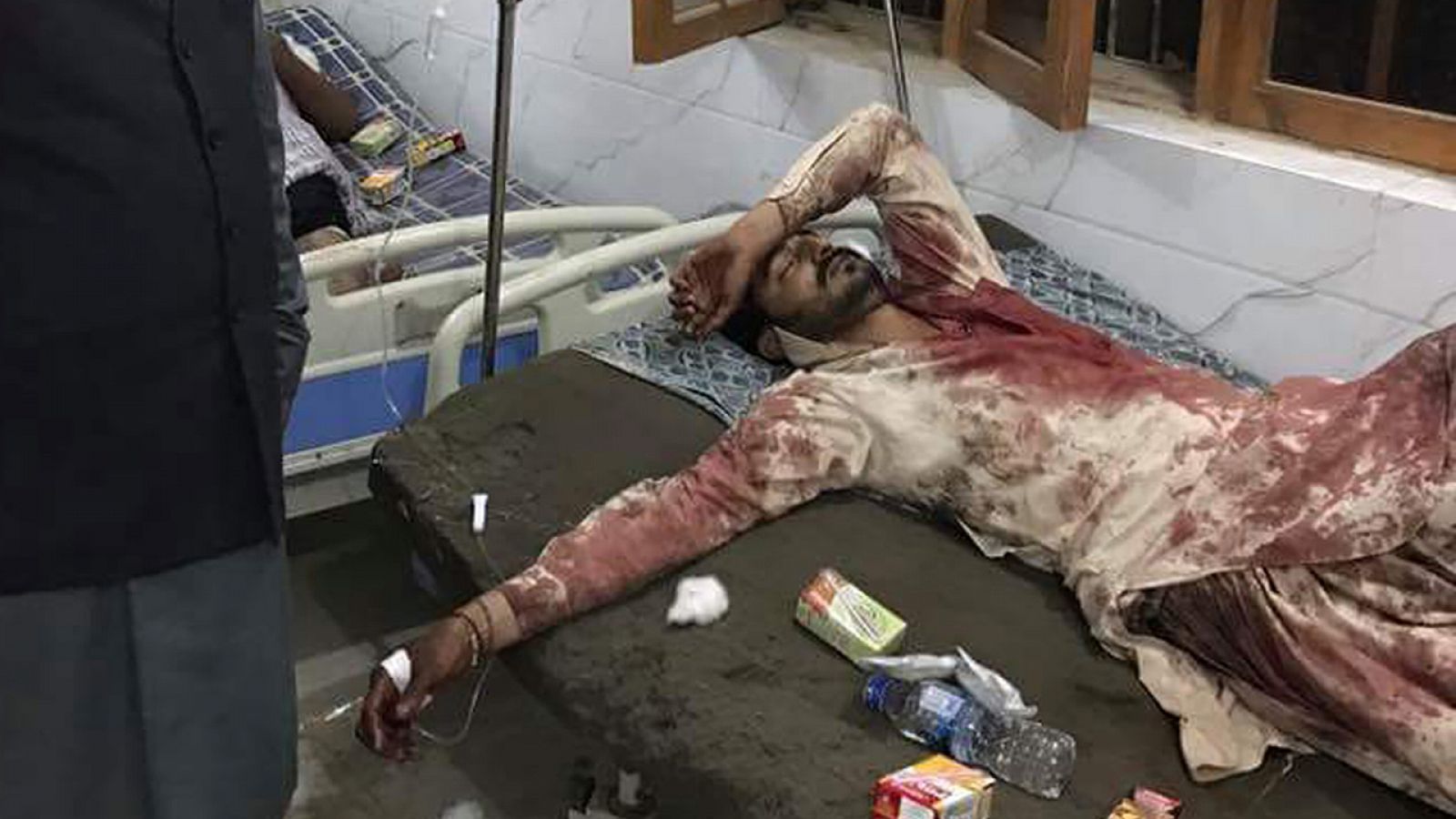 Un pakistaní yace herido en un hospital de Sehwan, Pakistán, tras un ataque con bomba contra un templo sufí