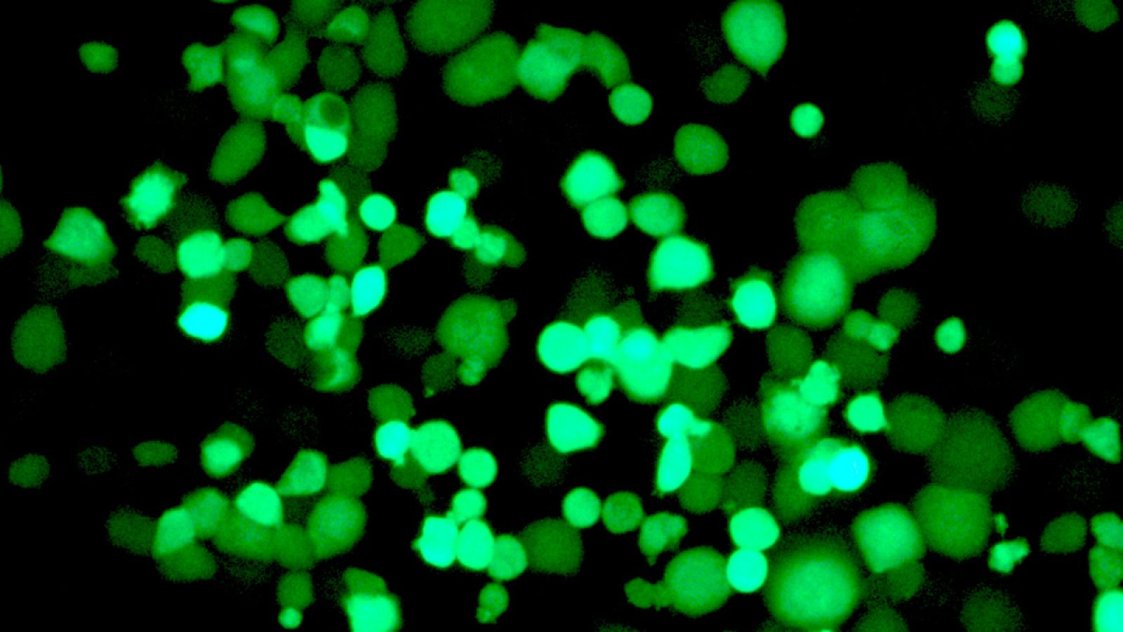 Células tumorales infectadas por el virus, que expresa una proteína fluorescente