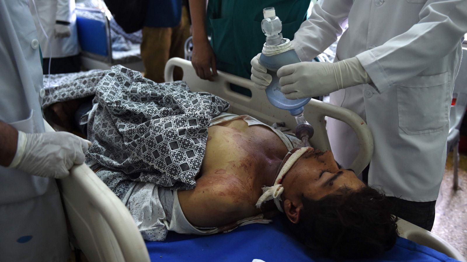 Sanitarios trasladan a un herido civil en el atentado este miercoles en Kabul