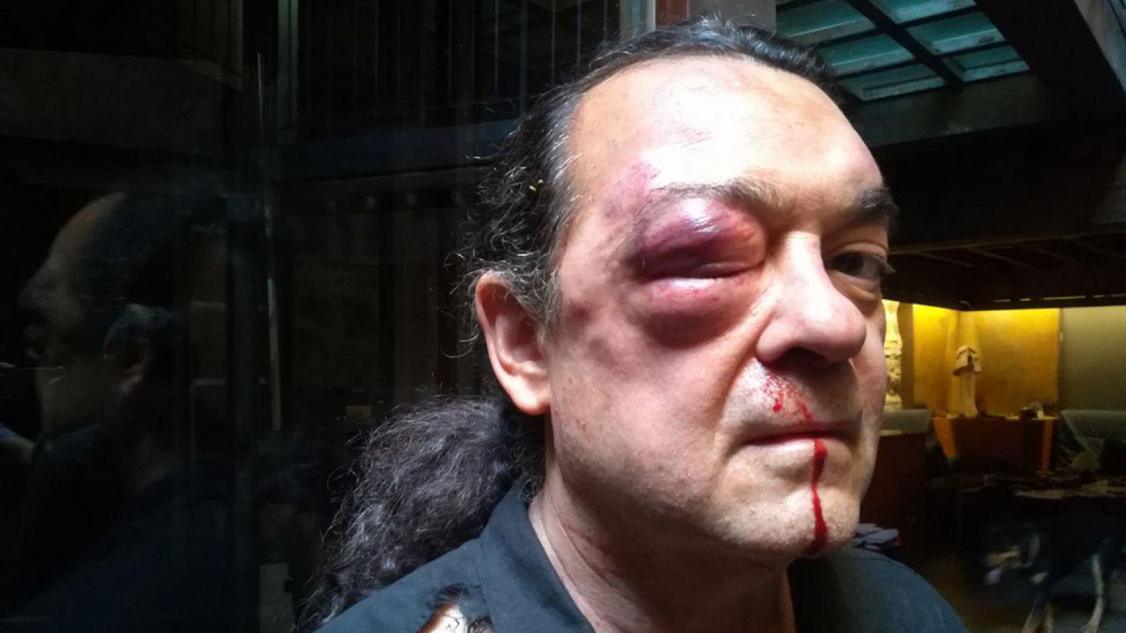 Heridas de la agresión al líder de Imagina Podemos en Castilla-La Mancha, Fernando Barredo