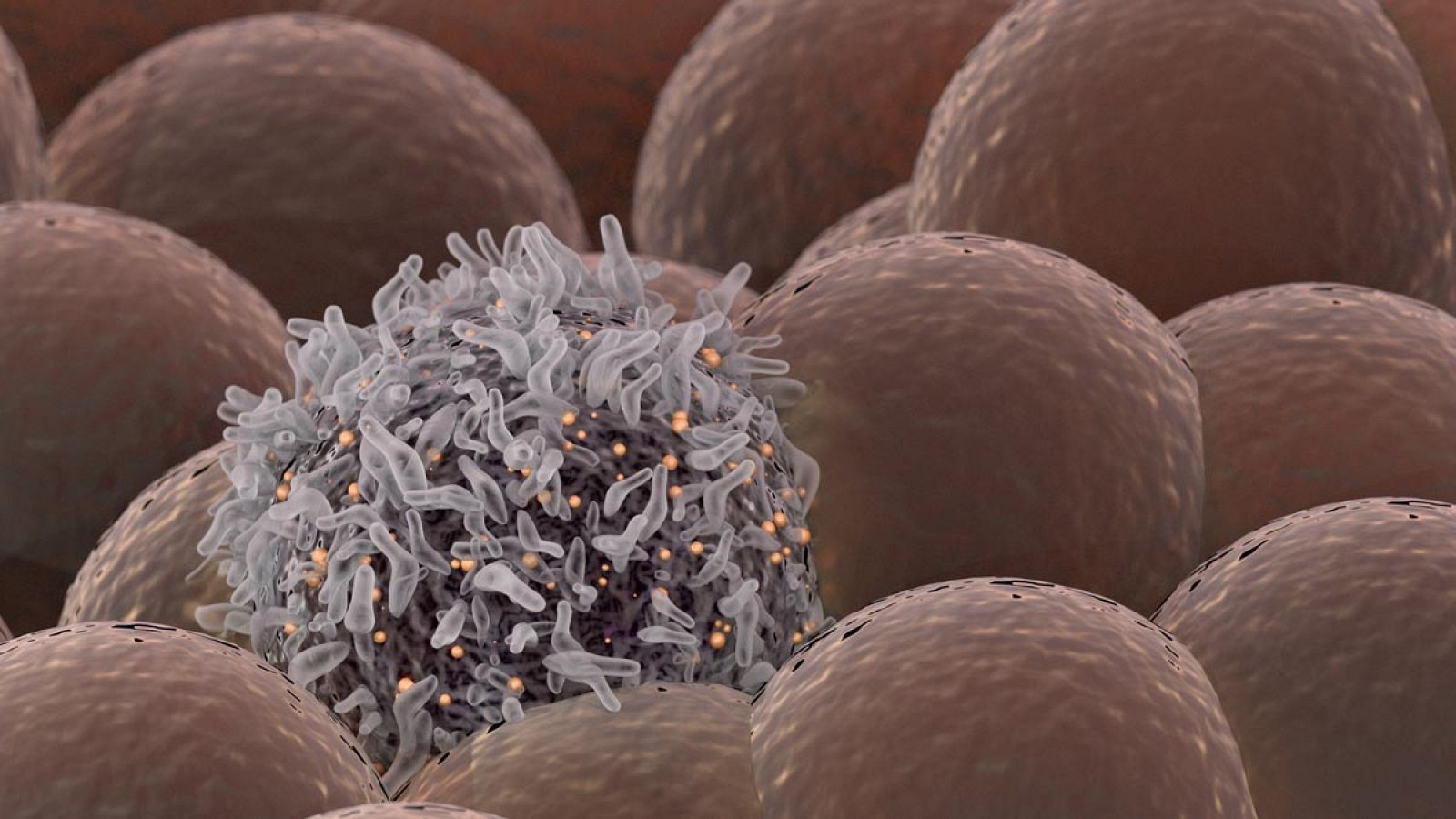 Una célula cancerígena rodeada por células sanas