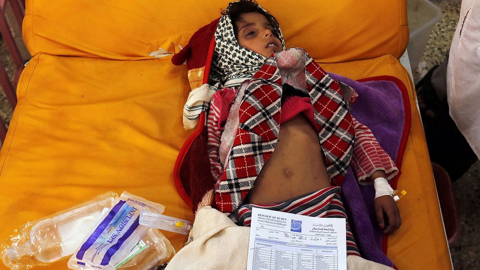 Una niña yemení enferma de cólera recibe tratamiento en un hospital en Saná (Yemen)