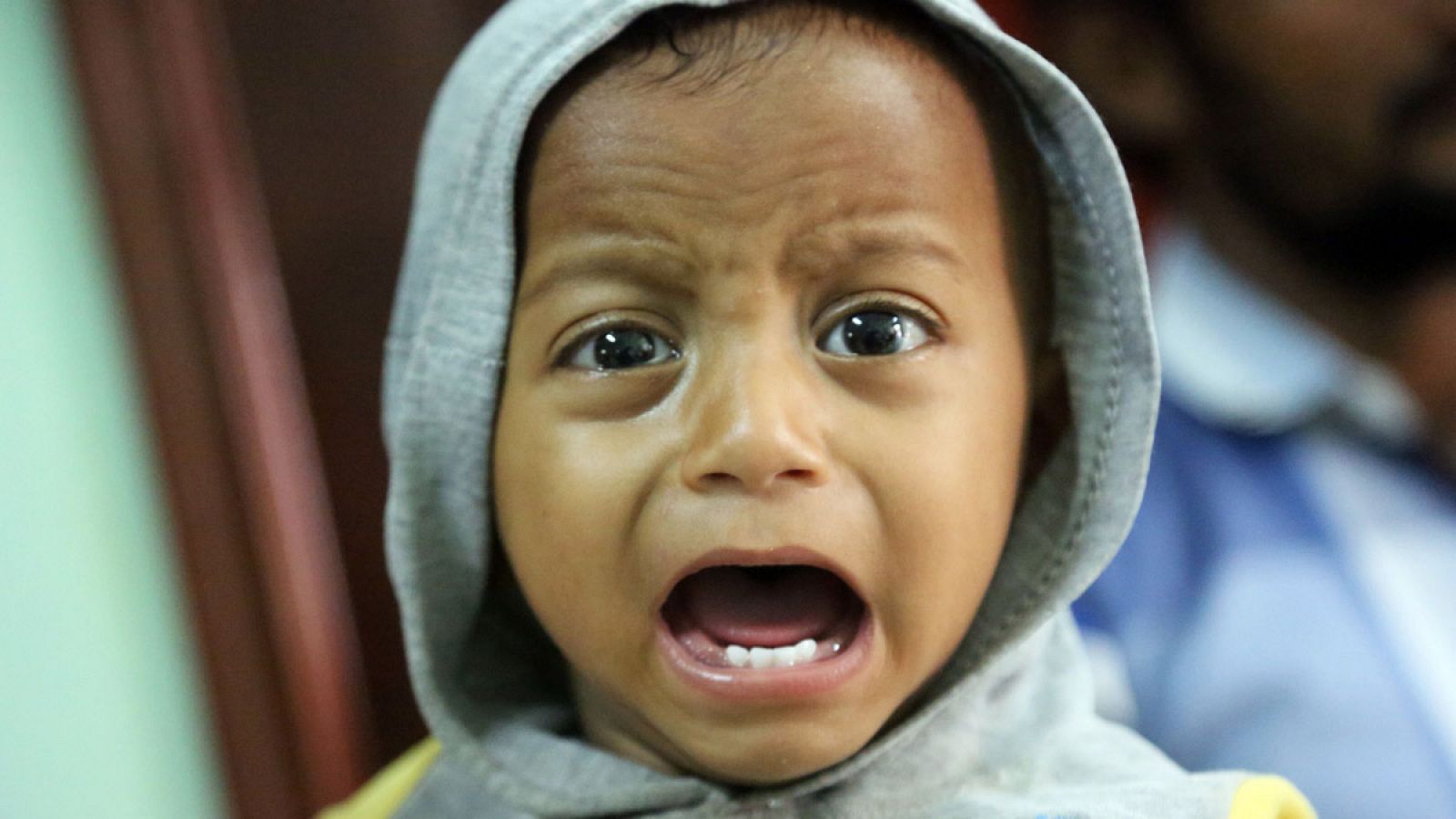 Un niño yemení, sospechoso de padecer cólera, llora en un hospital