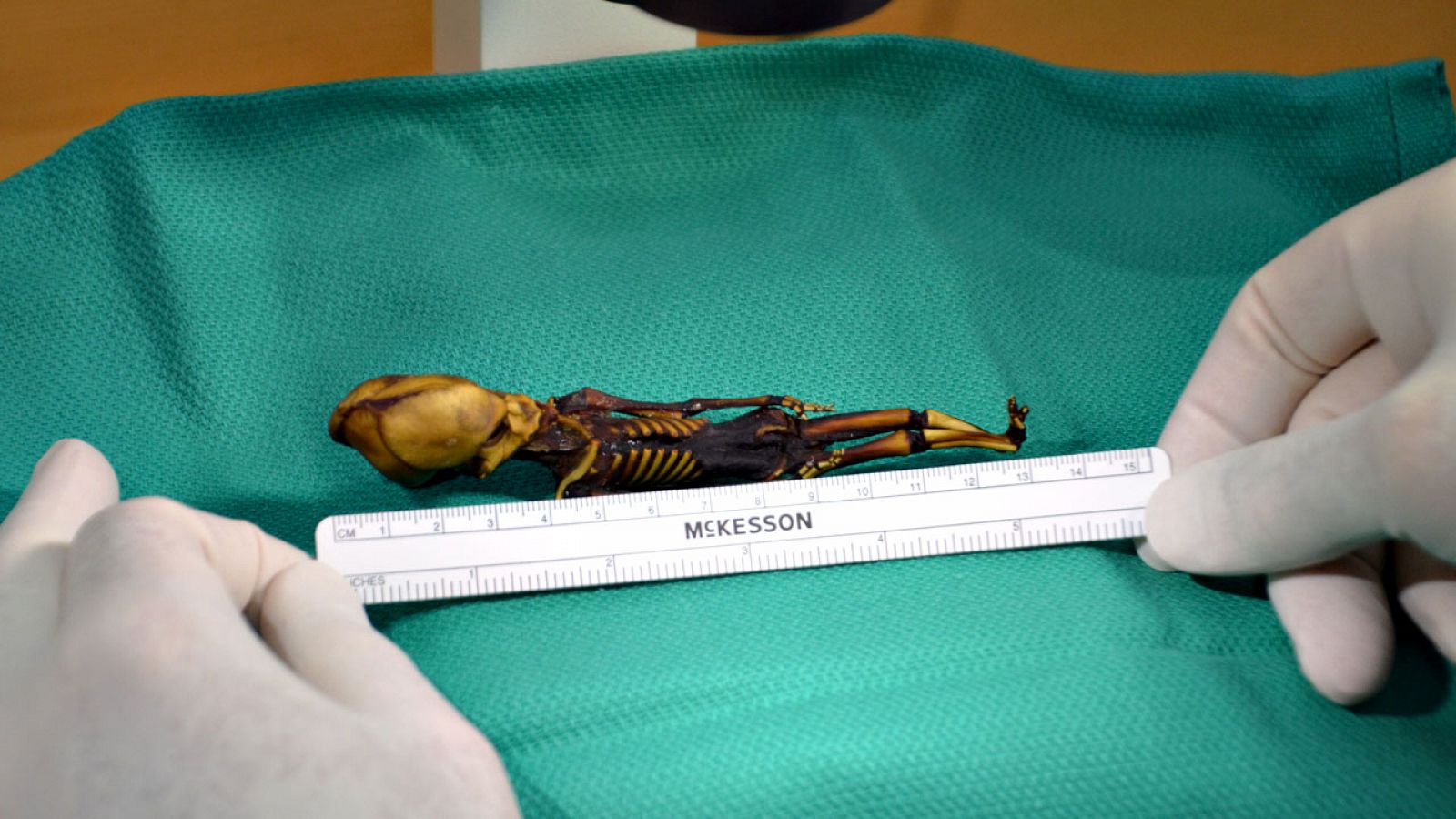 El esqueleto 'Ata', hallado en el desierto de Atacama, es el de un feto de niña con mutaciones óseas