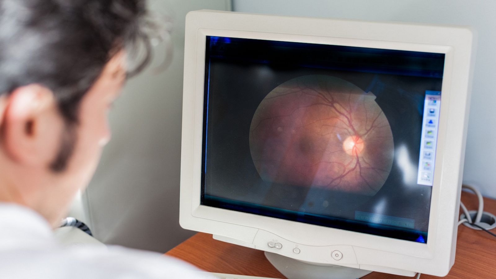 La degeneración macular asociada a la edad ocasiona una ceguera progresiva.