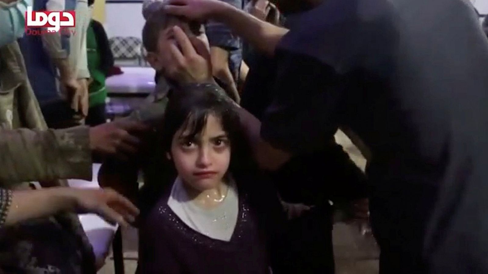 Una niña, afectada por el supuesto ataque químico sobre Duma (Siria), en una imagen facilitada por la ONG Cascos Blancos