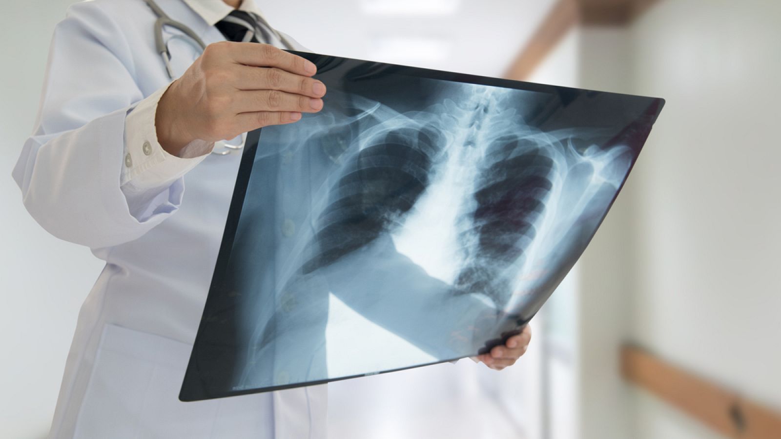 El cáncer de pulmón sigue siendo el que más muertes provoca en el mundo.
