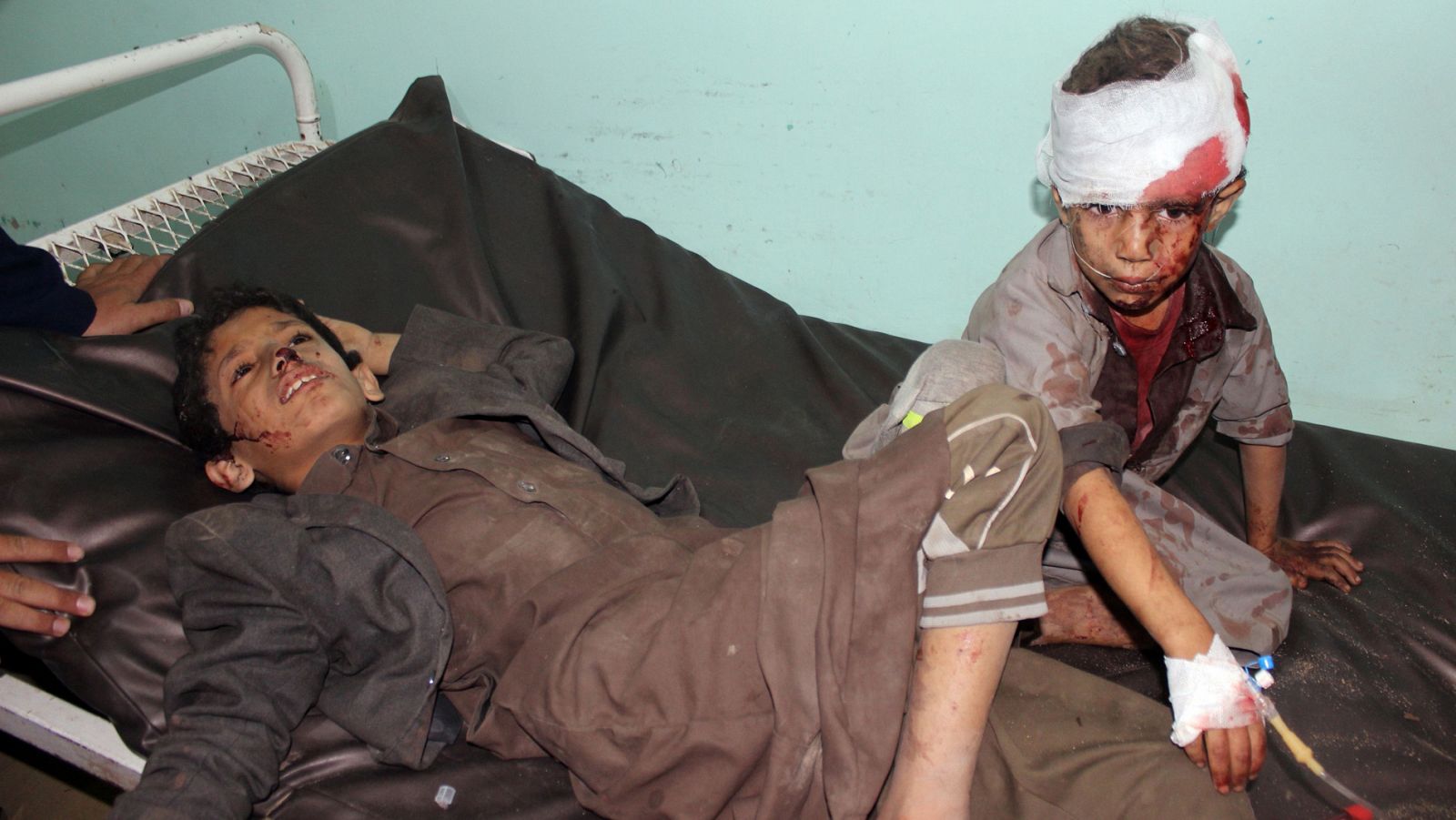 Niños yemeníes heridos en el ataque en Sadaa son atendidos por servicios sanitarios