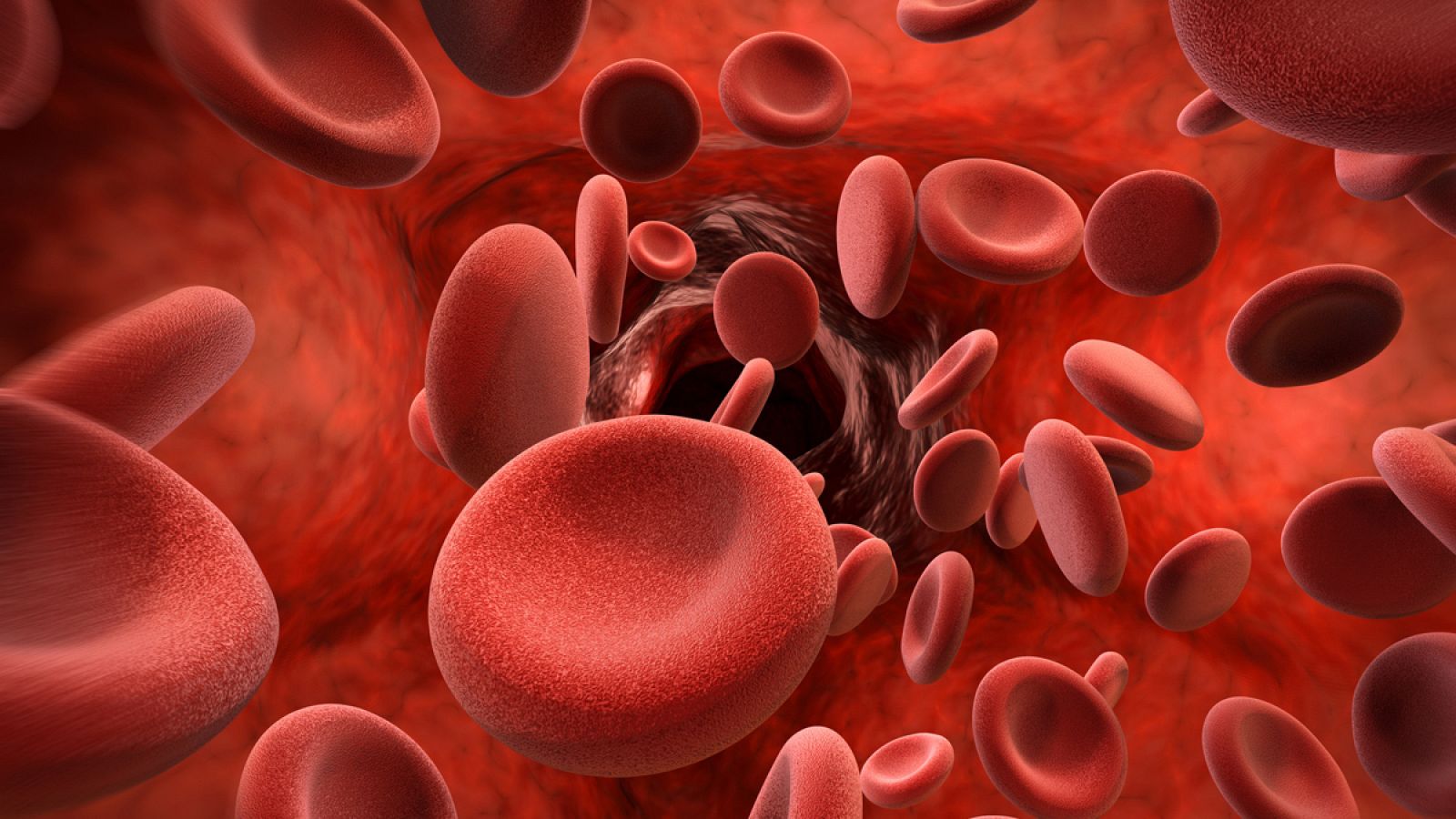 El tratamiento con heparina es habitual en enfermos con riesgo de presentar trombos sanguíneos.