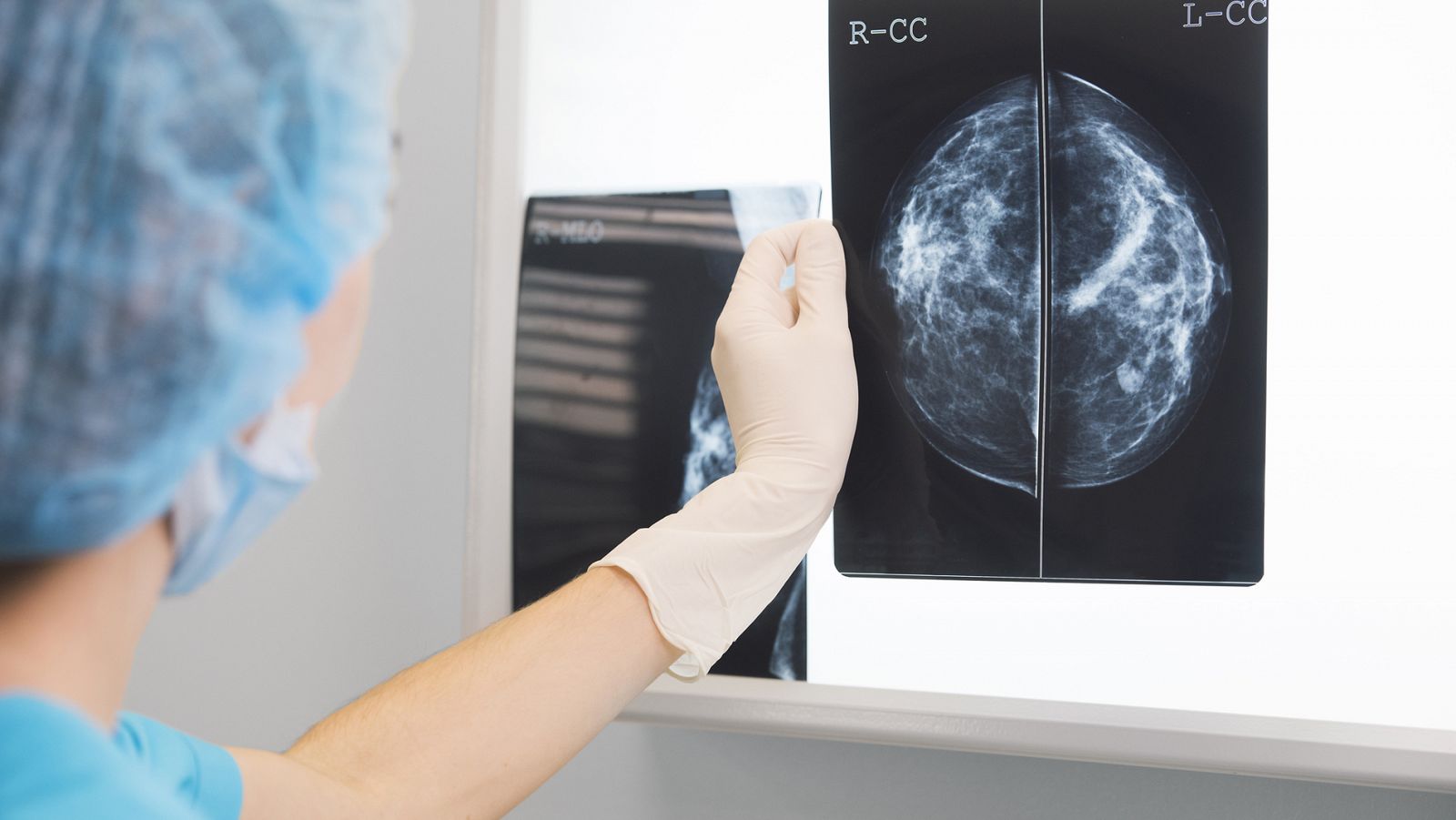 Una doctora inspecciona una mamografía