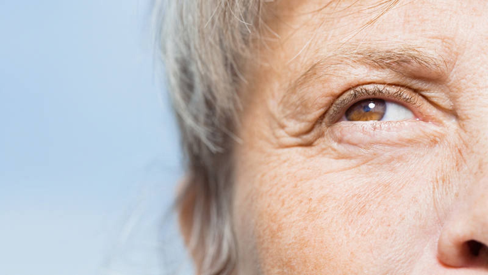 El envejecimiento de la piel, consecuencia de la pérdida de la capacidad de producir colágeno 