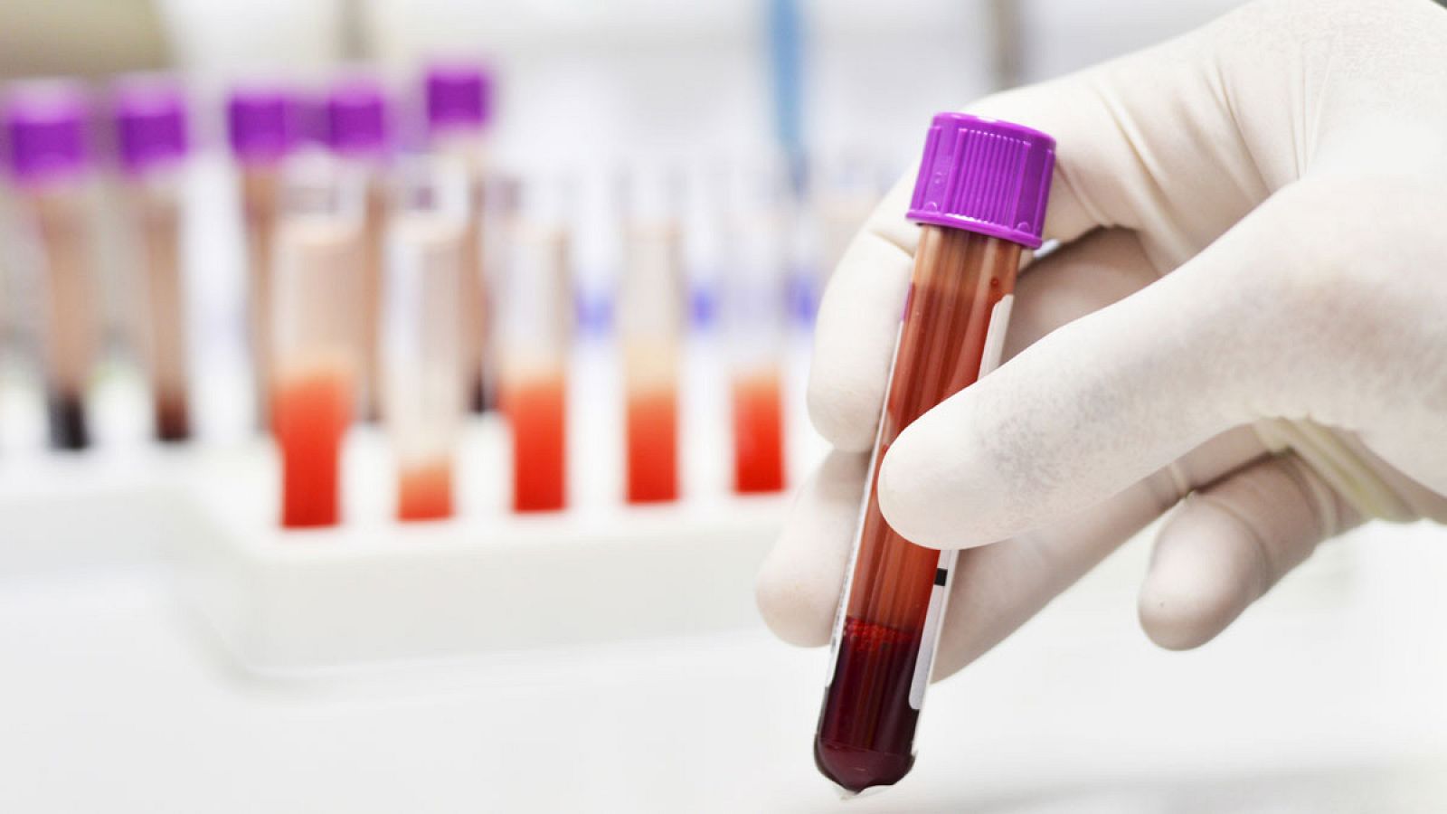Lograr diagnósticos mucho más tempranos en muestras de sangre aumentaría las posibilidades de curación.