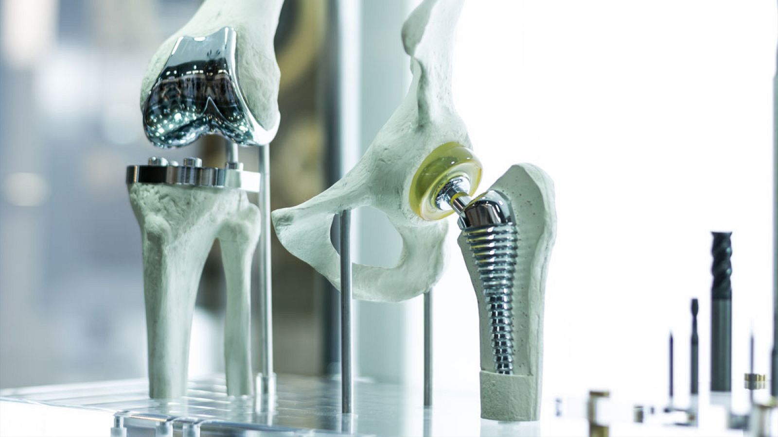 Imagen de archivo de un implante de cadera y de otro de rodilla.
