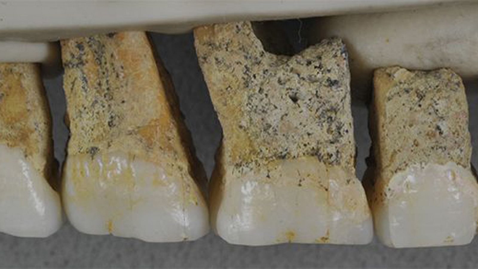 fotografía de la parte superior derecha de la dentadura del nuevo 'Homo luzonensis'