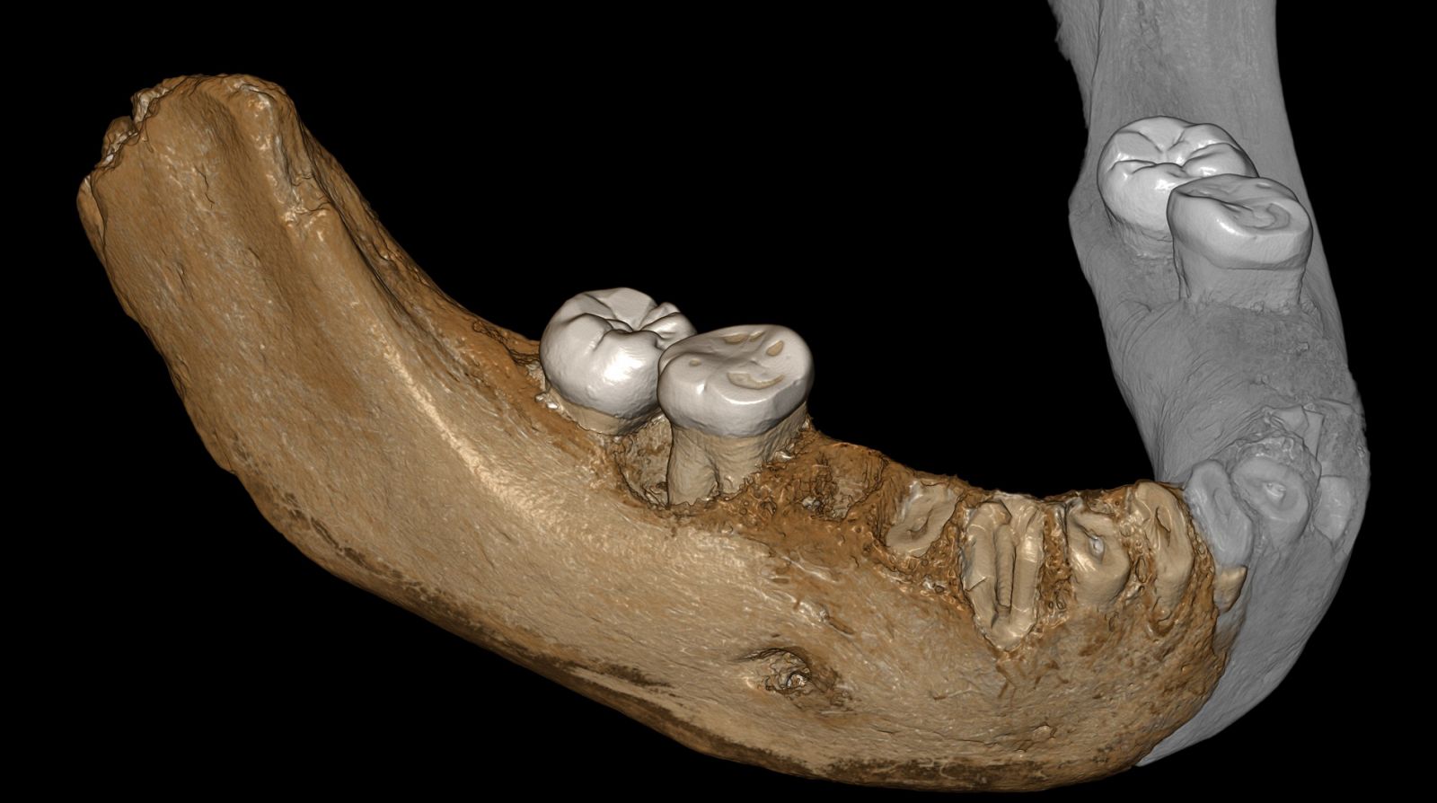 Reconstrucción de los dos lados de la mandíbula encontrada en el Tíbet de un homínido demisovano, las partes espejadas están en gris.