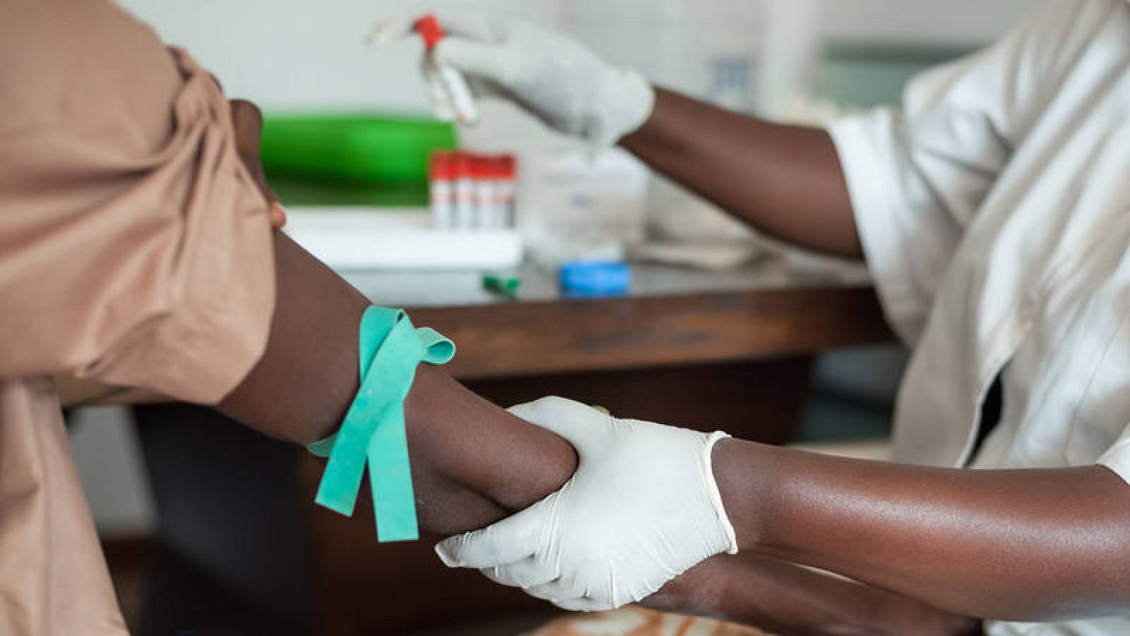 Una nueva técnica permite un diagnóstico más rápido del VIH en África