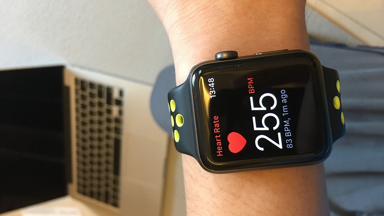 El electrocardiograma completo funciona con los Apple Watch de las series 4 y 5.
