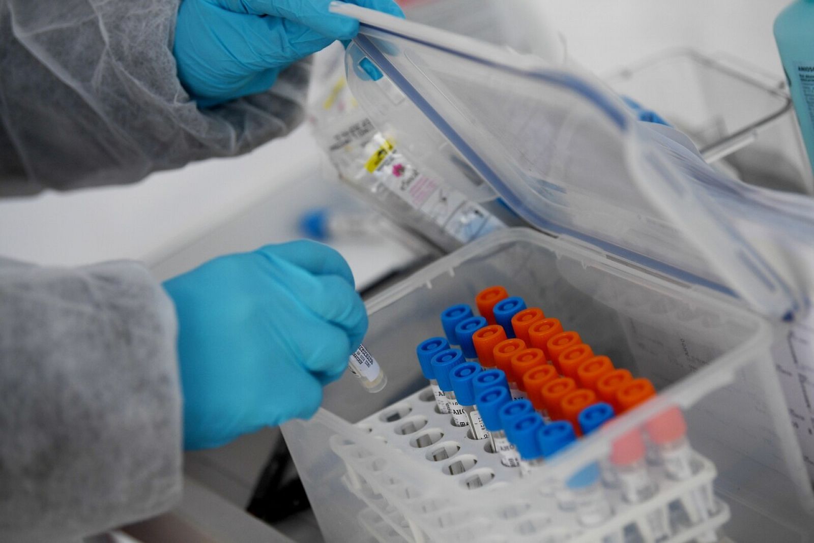 EE. UU. usará sangre de pacientes recuperados del coronavirus para tratar a enfermos críticos
