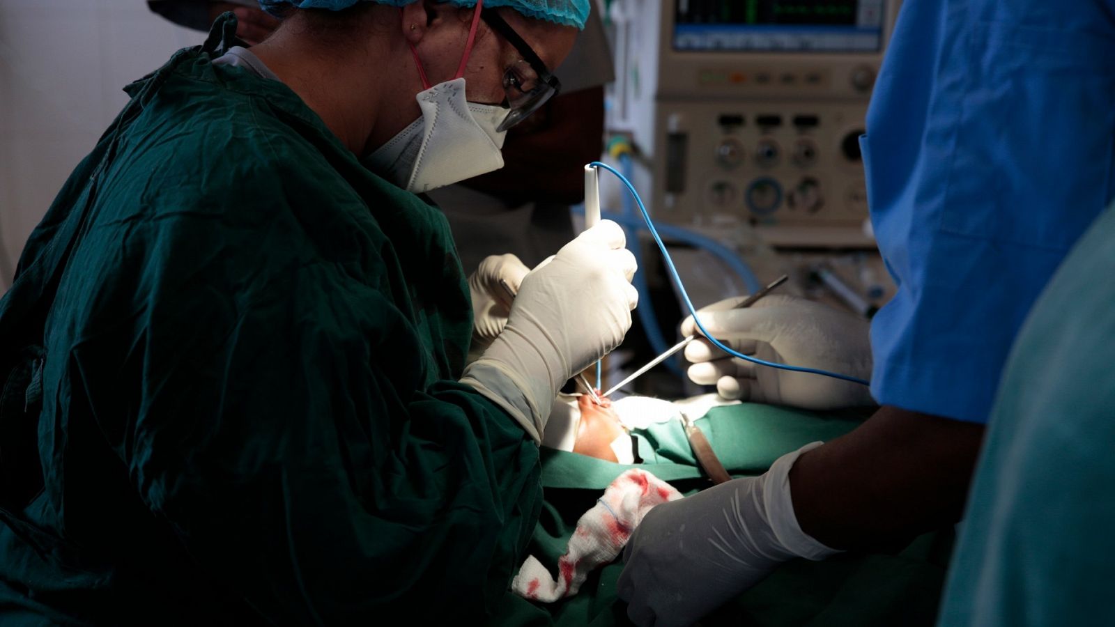 Un hospital de . realiza con éxito el primer trasplante del mundo de  cara y manos tras 23 horas de cirugía