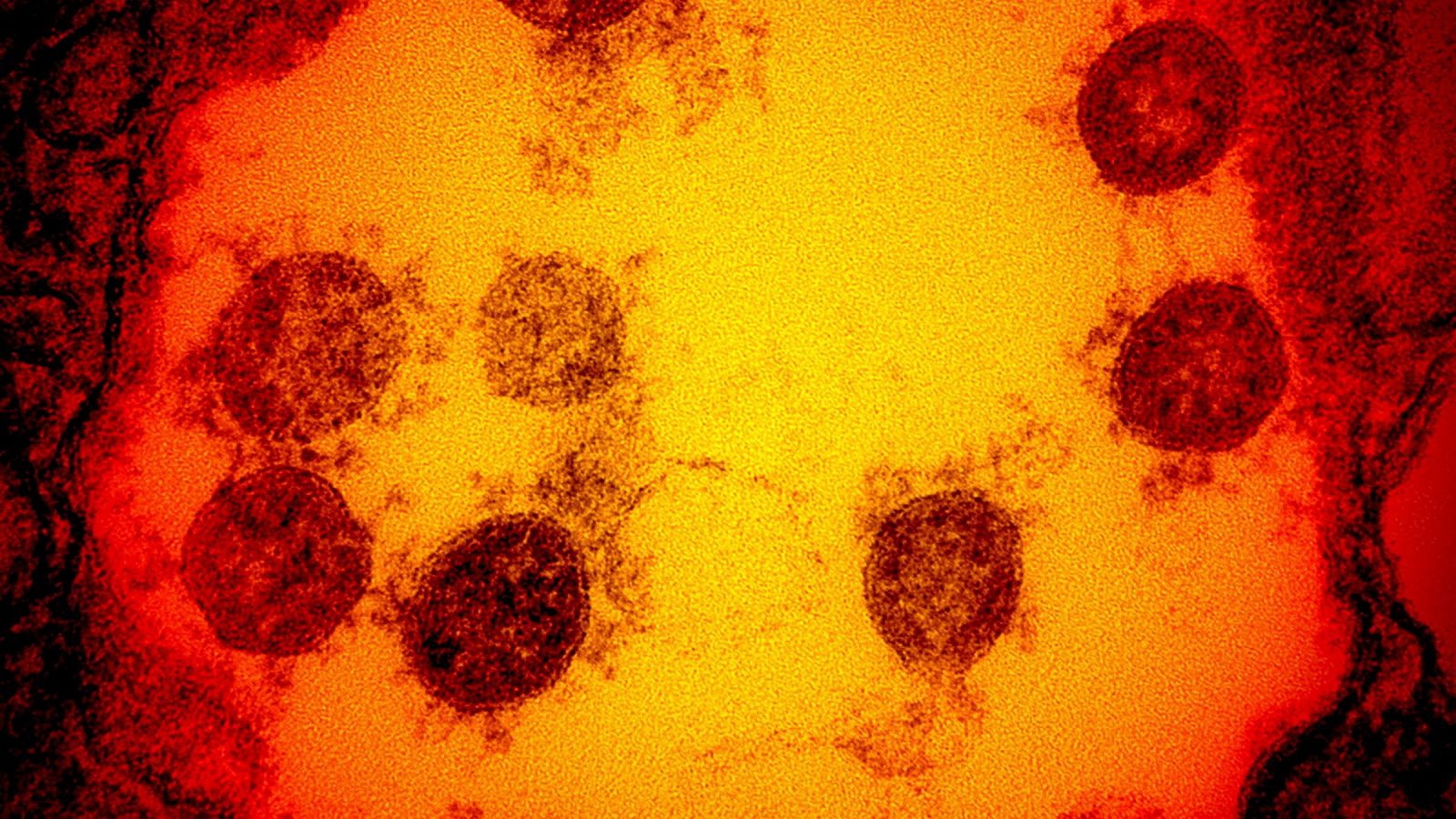 Micrografía electrónica de la transmisión de partículas del SARS-CoV-2, aisladas de un paciente, capturadas y coloreadas por el estadounidense Instituto Nacional de Alergias y Enfermedades Infecciosas (NIH/NIAID)