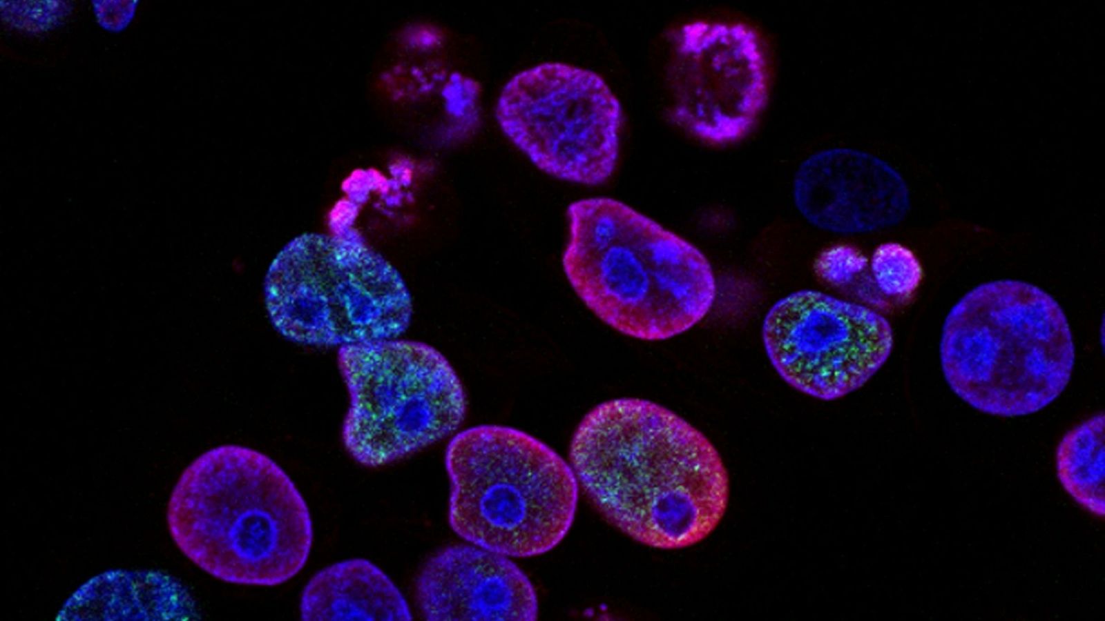 Células cáncer colorrectal humano