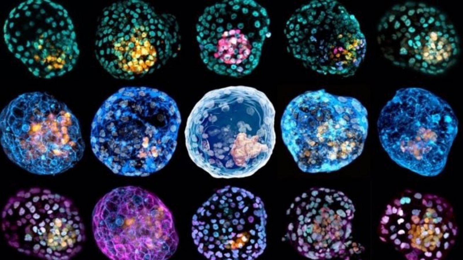 'iBlastoide', modelos de embrión prematuros desarrollados el equipo científico de la Universidad Monash, Australia, liderado por el argentino José Polo.
