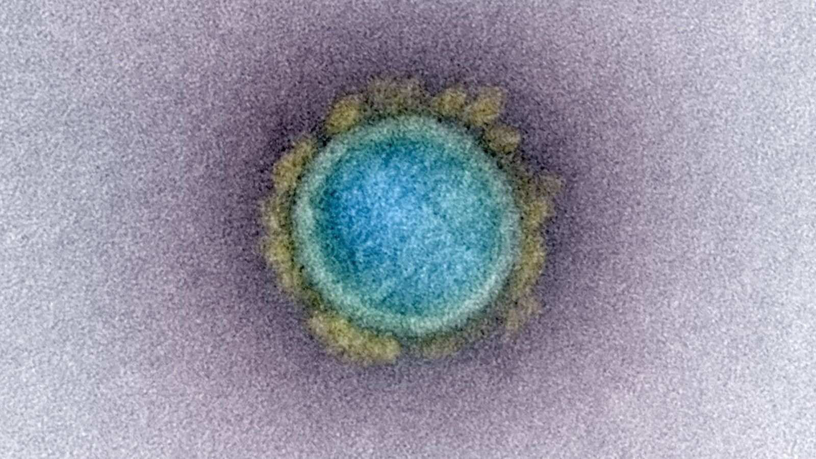 Imagen real del SARS-CoV-2 con color falso. Micrografía electrónica de transmisión de una partícula de virus SARS-CoV-2, aislada de un paciente. Imagen capturada y mejorada con color en la Integrated Research Facility (IRF) del NIAID (febrero de 2020