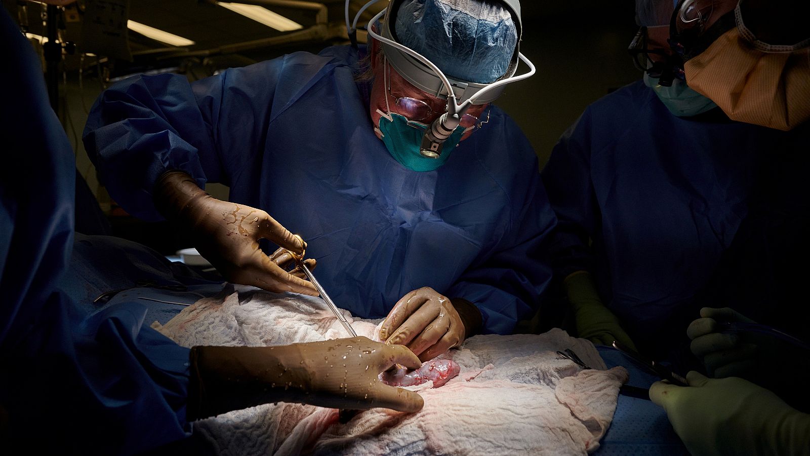 La operación quirúrgica se ha llevado a cabo en el centro NYU Langone Health, de Nueva York.