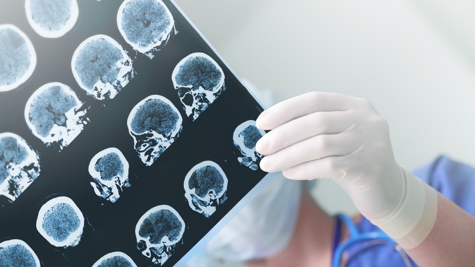 Un investigador sostiene las imágenes de una prueba de escáner cerebral