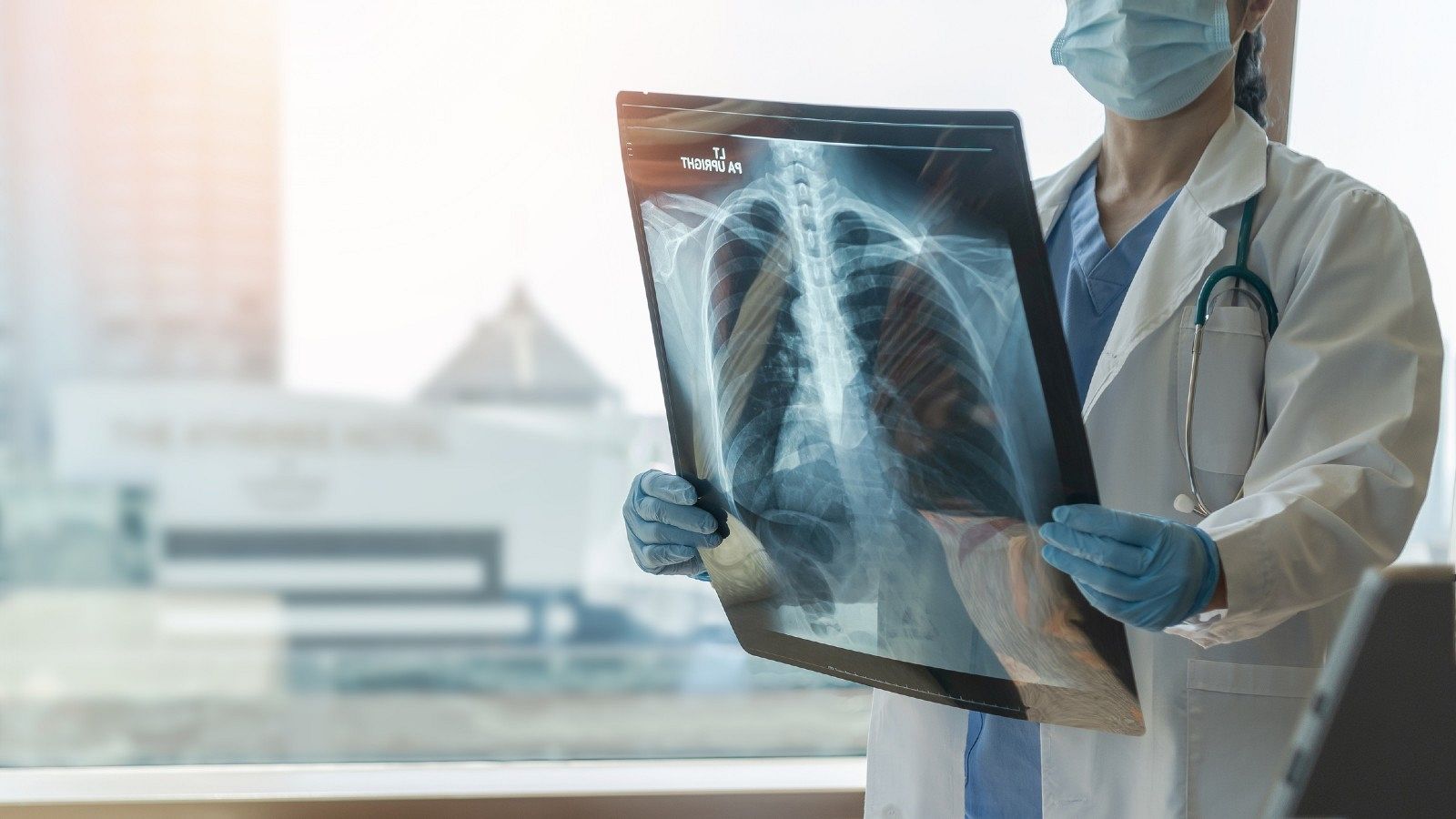 Día Mundial contra el Cáncer: una doctora observa la radiografía de unos pulmones