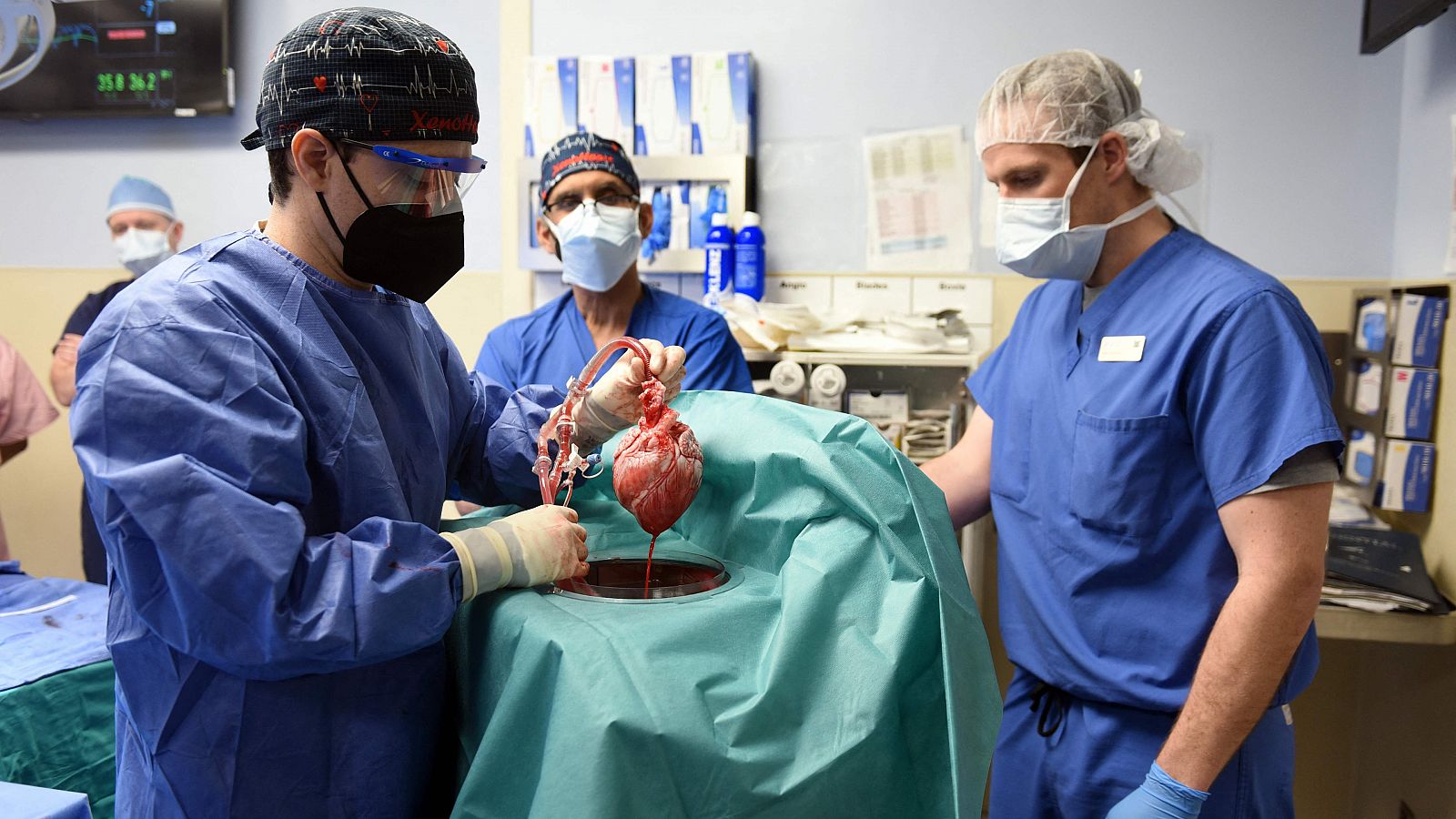 El equipo médico muestra el corazón de cerdo trasplantado a David Bennett.