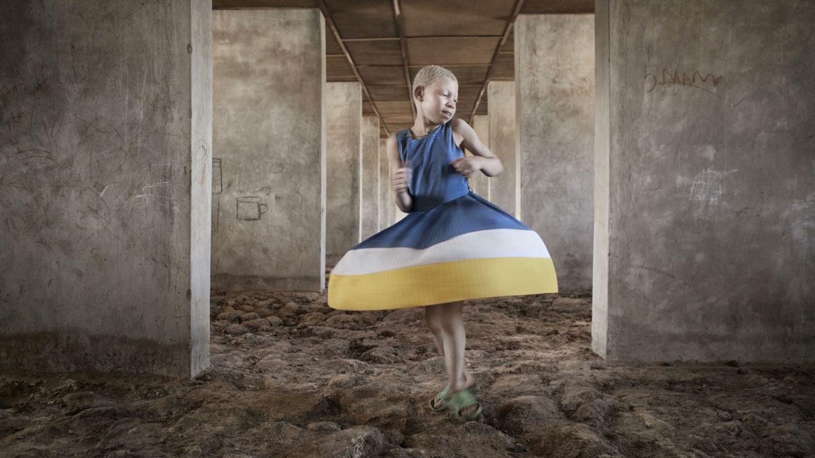 Kelen, la niña albina en el refugio de Kabanga