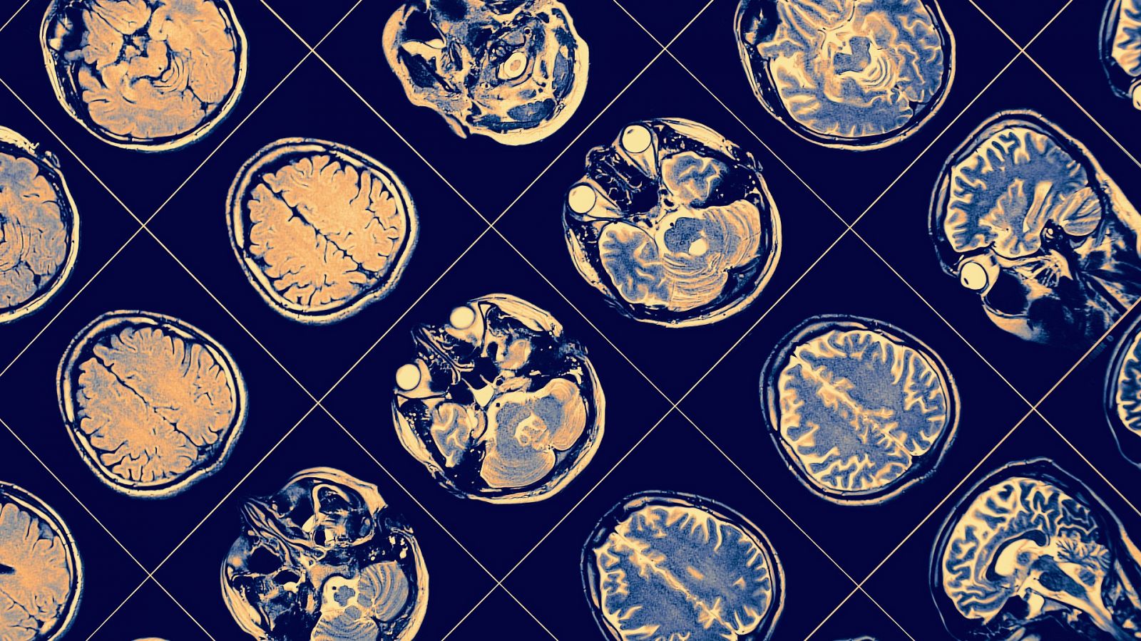 Escáneres cerebrales, en una imagen de archivo.