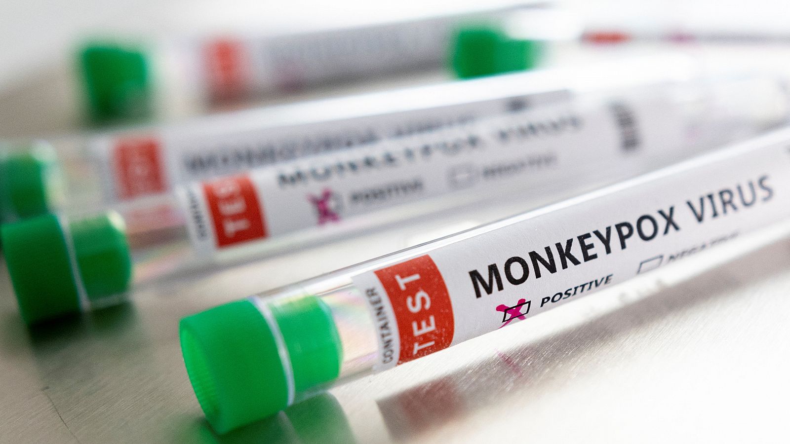 Representación de varios recipientes con resultados de viruela del mono, viruela símica o 'monkeypox'.