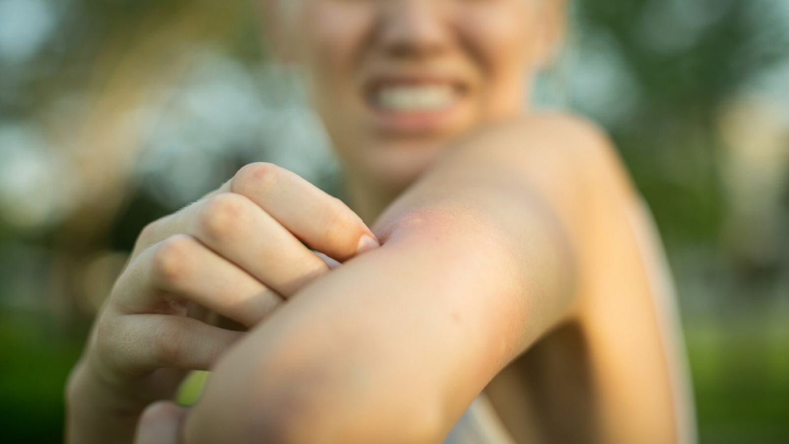 Los mosquitos y las picaduras con Enfermera Saturada