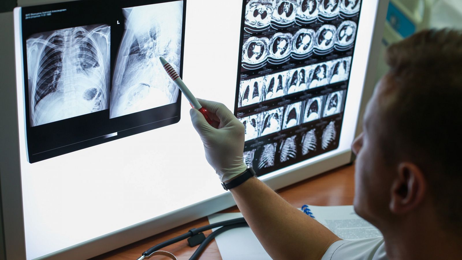 Un investigador observa una radiografía de pulmón, en una imagen de archivo
