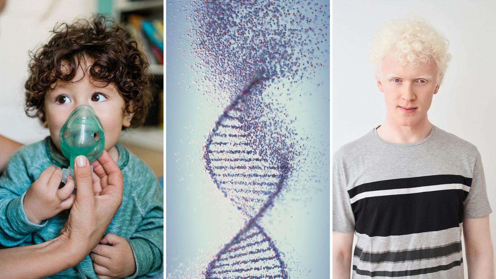 La fibrosis quística y el albinismo son dos de las enfermedades raras más conocidas