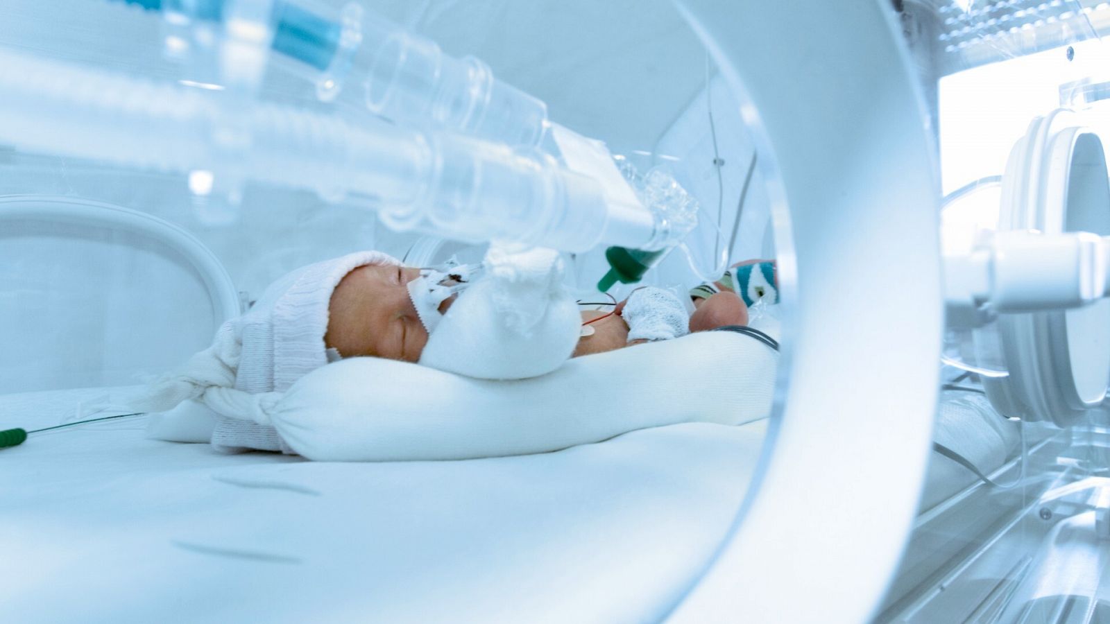 Un bebé recién nacido en una UCI neonatal