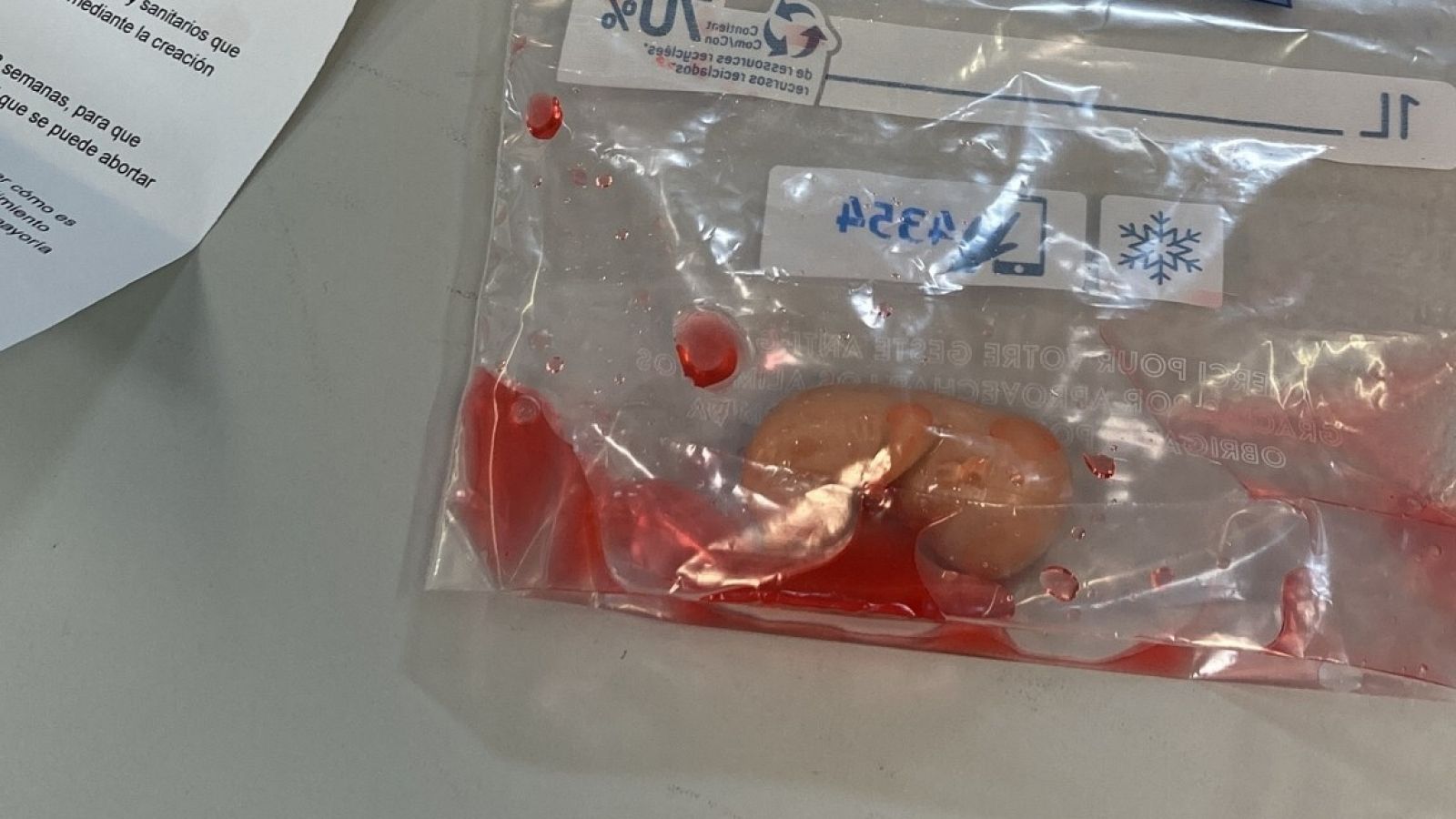 Una de las bolsas con una réplica de un feto de 12 semanas