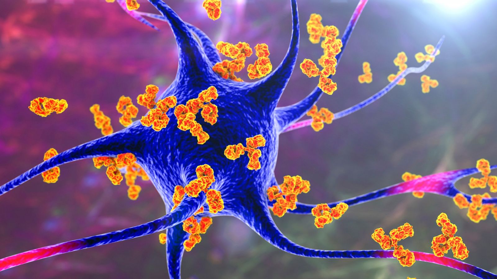 Antibodies attacking neurons. Conceptual computer illustration of autoimmune neurologic diseases