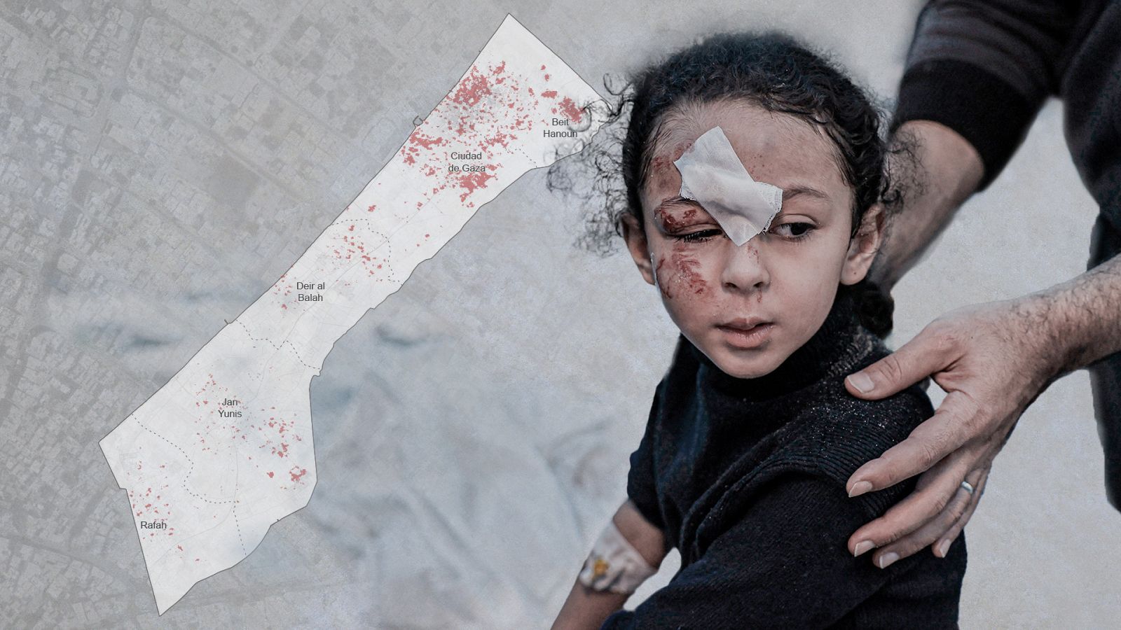 Una niña herida recibe tratamiento en un hospital en Rafah.