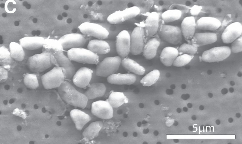 Los investigadores Instituto de Astrobiología de la NASA encontraron a la bacteria de la familia Halomonadaceae en las aguas tóxicas y salobres del Lago Mono, en California.