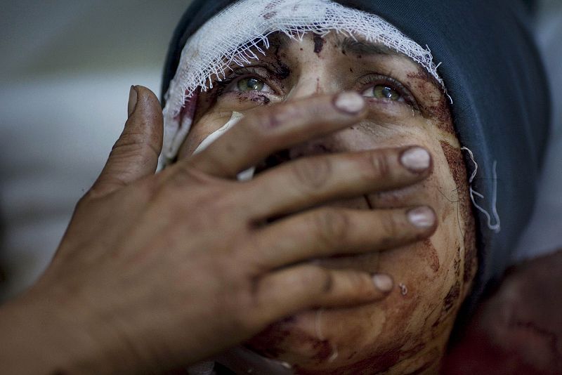 Aida se recupera de las heridas tras el bombardeo de su casa en Idib, Siria. Esta fotografía le ha deparado el primer premio en la categoría de Información General de imágenes individuales al argentino Rodrigo Abd.