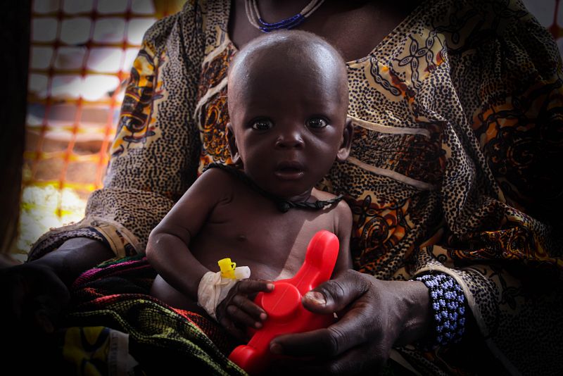 La malnutrición severa causa la muerte de 121 niños de cada 1000 en la región de Sikasso. A nivel nacional la prevalencia es de 91 por cada 1.000.