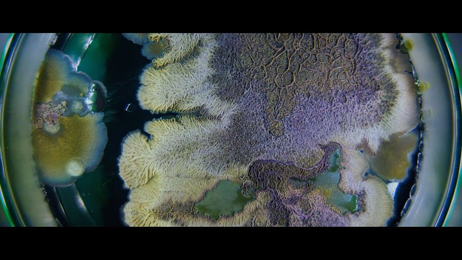 imagen microscópica expansión de la resistencia de una bacteria a un antibiótico.