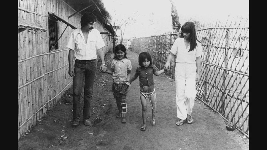 Un hombre y una mujer con dos niñas con piernas ortopédicas