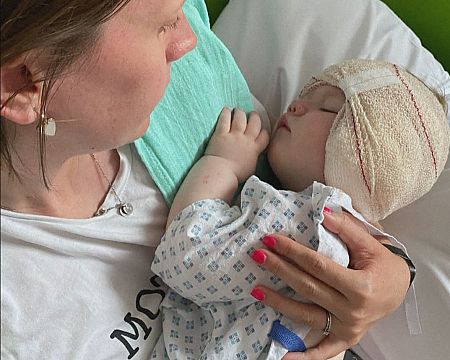 Opal Sandy, la niña, junto a su madre después de la operación
