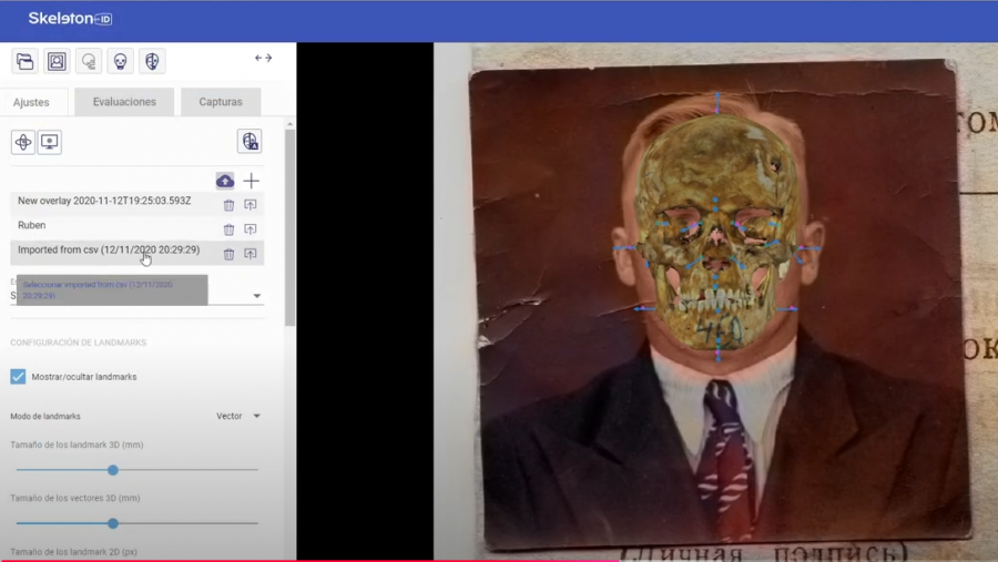 Una superposición craneofacial realizada con el programa Skeleton-ID
